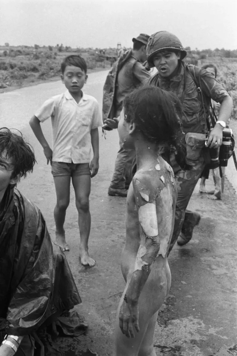 Las llamas y el napalm quemaron primero el brazo izquierdo de Kim y su sencilla ropa de algodón se derritió sobre su piel: una desgracia que evitó también que el napalm se quedara a vivir en su cuerpo