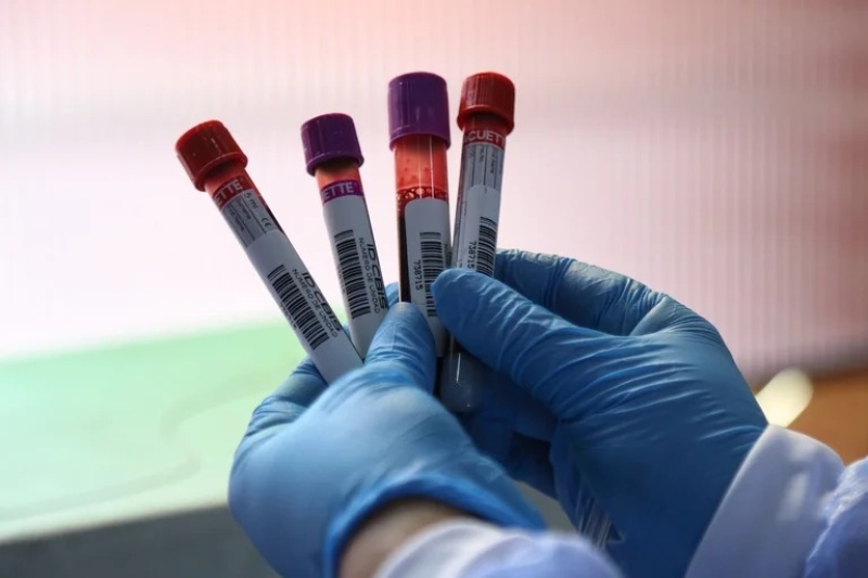 Sangre cultivada en laboratorio: por primera vez dos pacientes recibieron material sanguíneo artificial