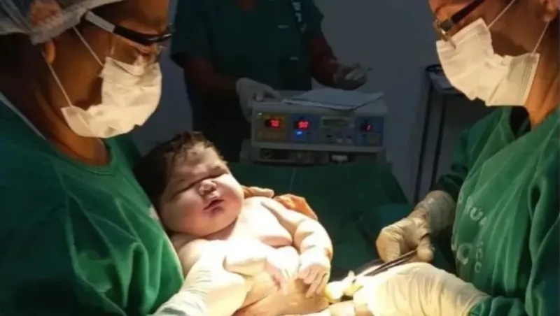 Brasil: nació un superbebé de más de 7 kilos y rompió un récord