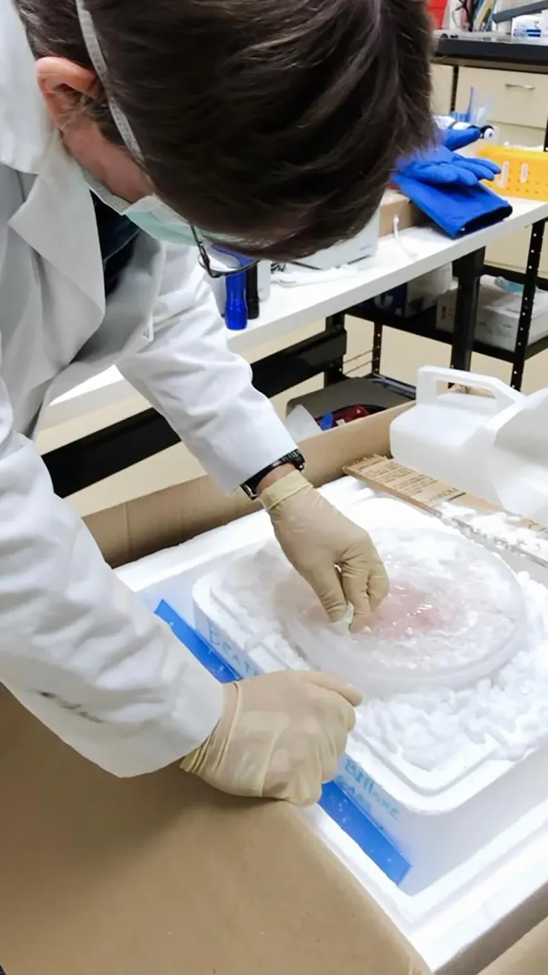 El cerebro de Beatriz Bilone, recién llegado a las instalaciones de 21St Century Medicine. Su hija María y el biólogo Greg Fahy revisan su estado y luego lo colocan en un tanque de nitrógeno líquido.