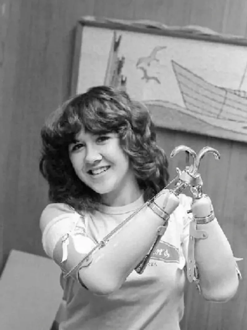 Mary sentía que se iba a desmayar, pero enseguida la adrenalina volvía y pensaba que debía sobrevivir. Finalmente, huesos, músculos y cartílagos cedieron y ella quedó liberada. Sus dos brazos se habían separado de su cuerpo