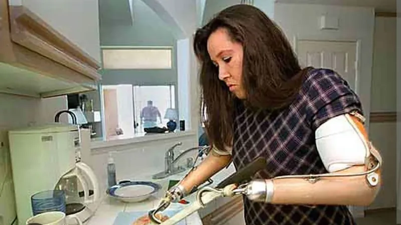 Mary aprendió a usar los brazos ortopédicos para su vida cotidiana