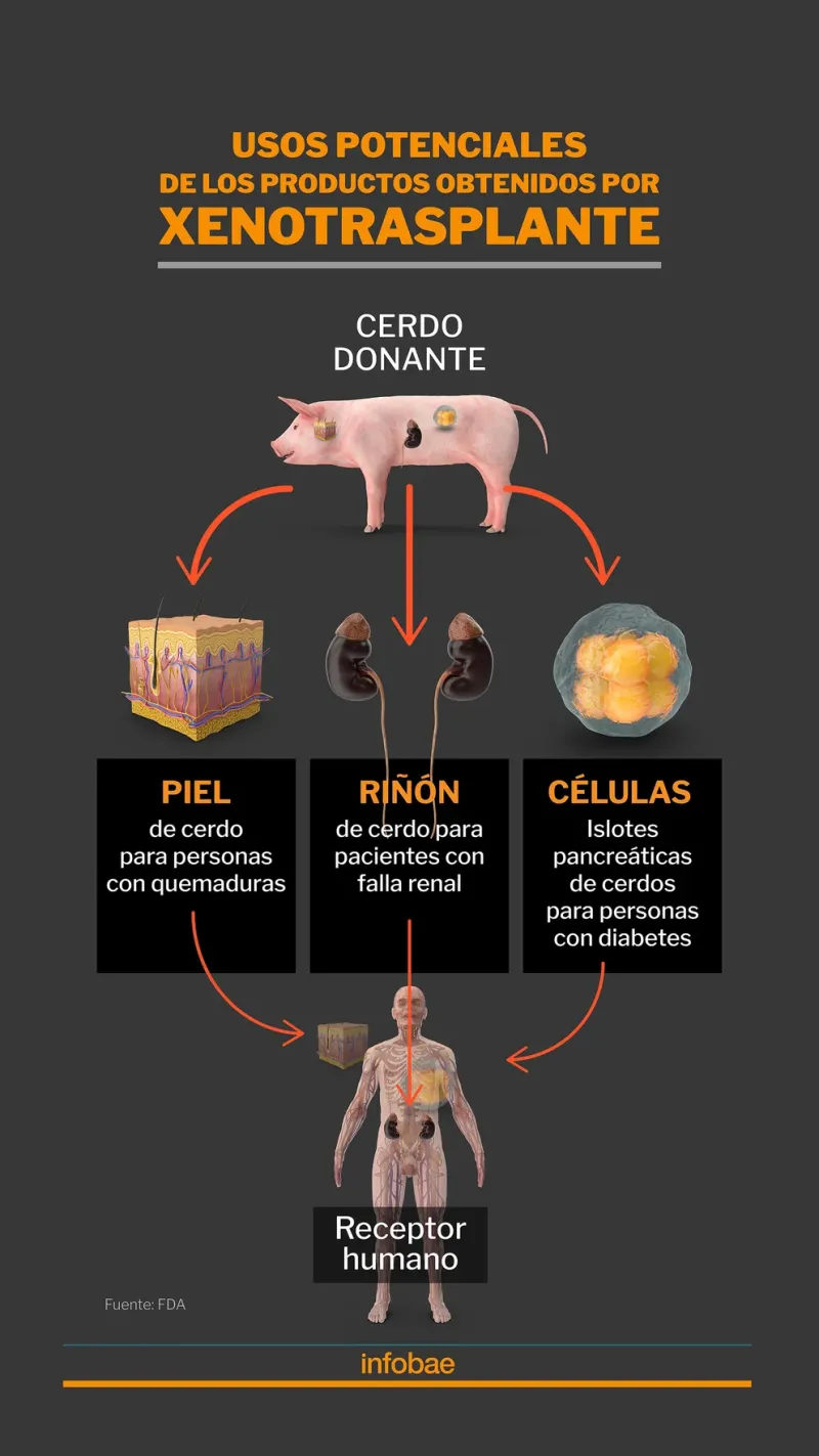  Posibilidades de trasplante de órganos de cerdo a un ser humano (Marcelo Regalado)