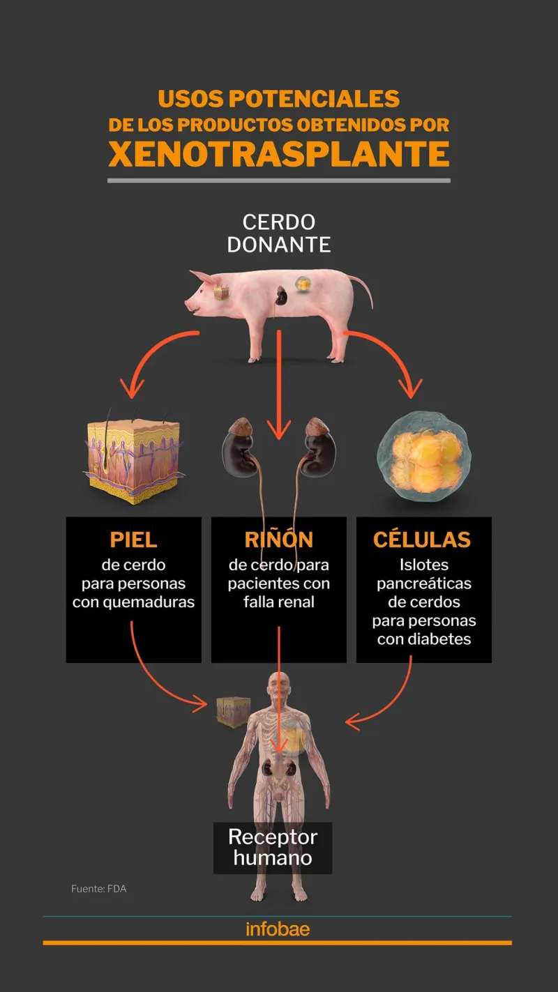  Posibilidades de trasplante de órganos de cerdo a un ser humano (Marcelo Regalado)