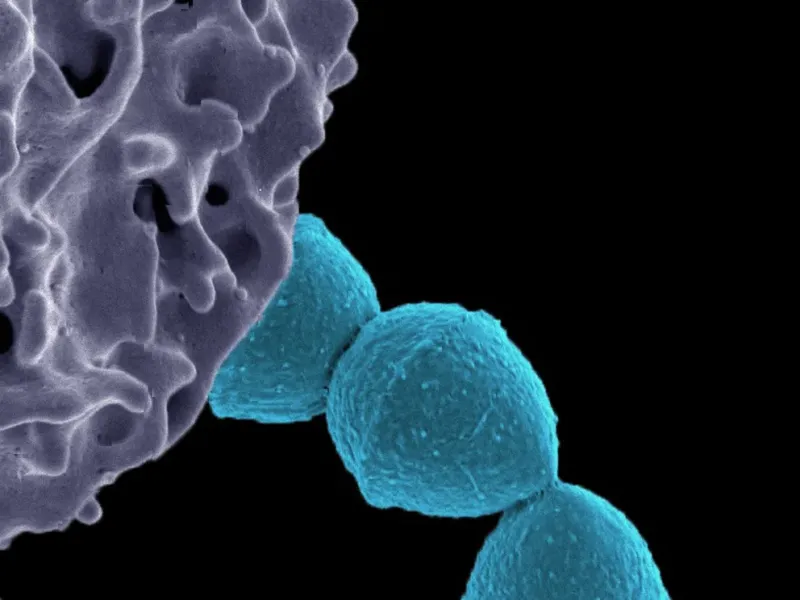 La bacteria Streptococcus pyogenes puede causar faringitis, escarlatina, neumonías, infecciones localizadas en músculo, hueso o articulaciones e infecciones diseminadas en la sangre. Las infecciones invasivas son los cuadros más graves (National Institute