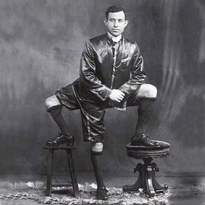 Francesco Lentini nació en un pueblo de Sicilia con 3 piernas (Wikipedia)