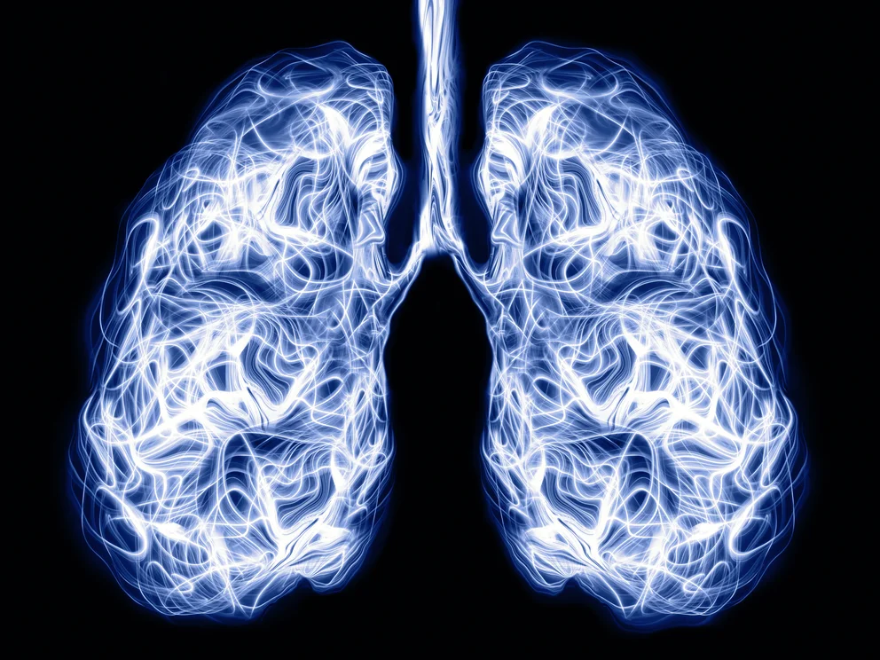 Cáncer de pulmón: aprobaron en Argentina un tratamiento innovador que combina dos terapias